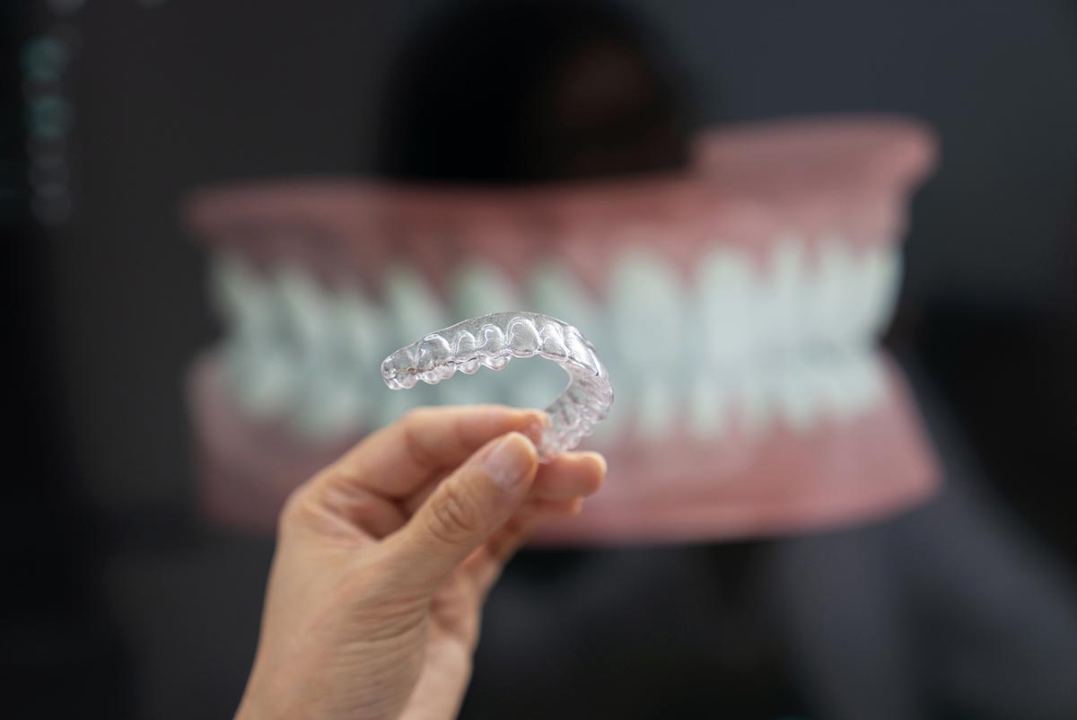 Aligner-Therapie - Kieferorthopädie für Erwachsene - Praxis Dr. Ibbels Aschaffenburg-Glattbach
